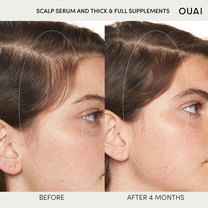 OUAI Scalp Serum - Hydrating Hair Serum with Red Clover Extract, Siberian Ginseng and Peptides